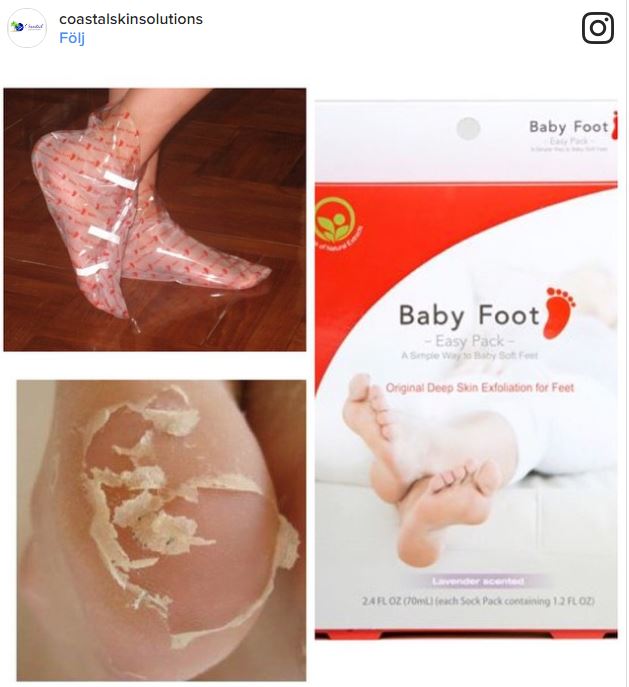 babyfoot-fotvardsbehandling