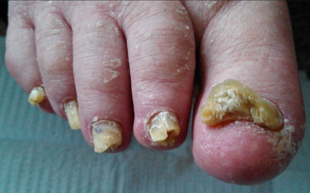 tanaglar-nagelbehandling